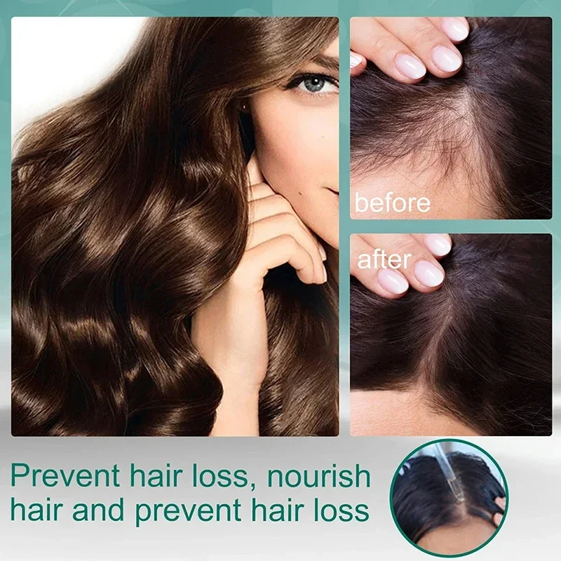 علاج سائل بأربعة أعشاب، مكونات - مراجعة Hair Care Natural Ingredients وسعره