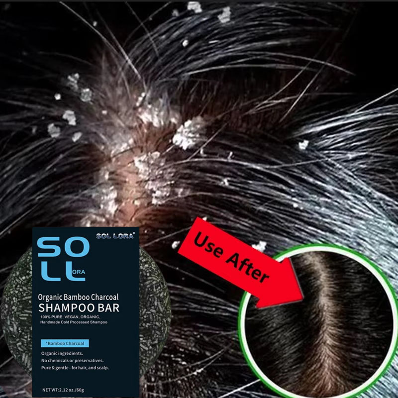 صابون سريع مضاد للقشرة لعلاج ا - مراجعة Hair Care Dandruff وسعره