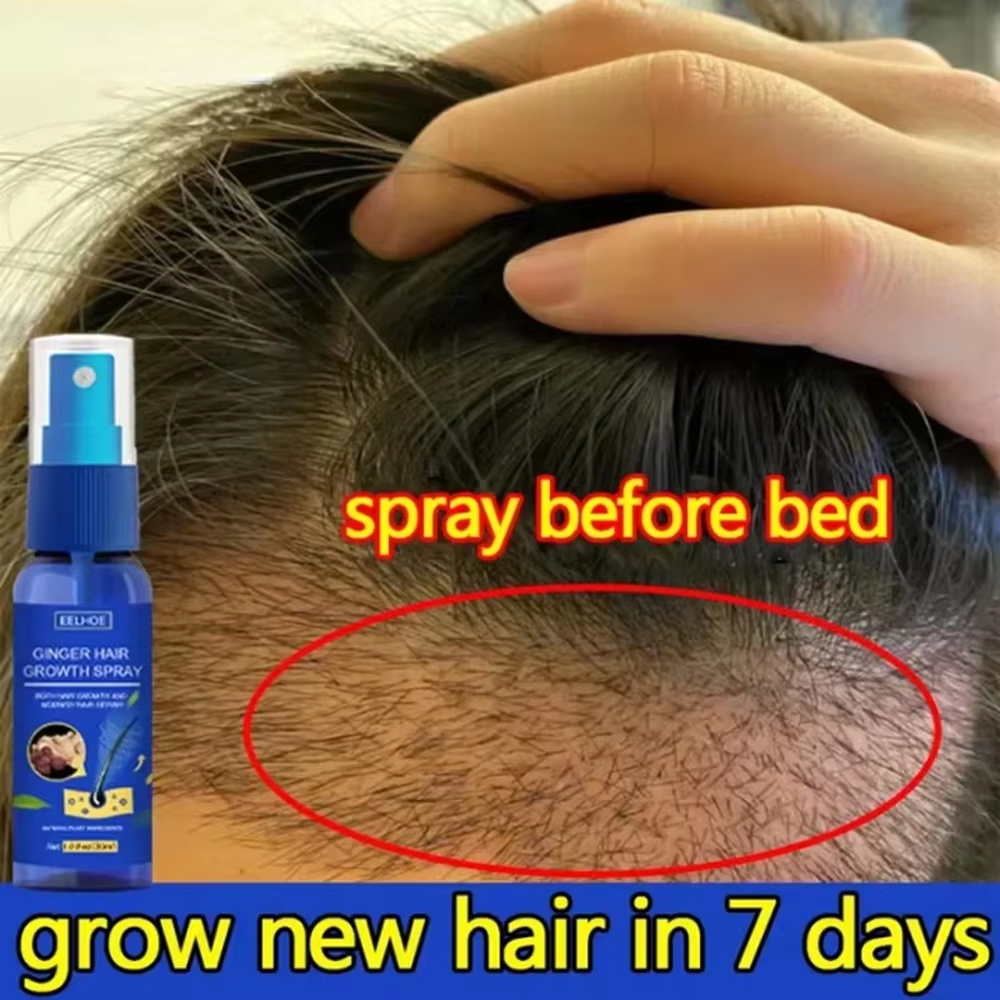 بخاخ الزنجبيل السريع لنمو الشع - مراجعة Hair Care Lotion وسعره