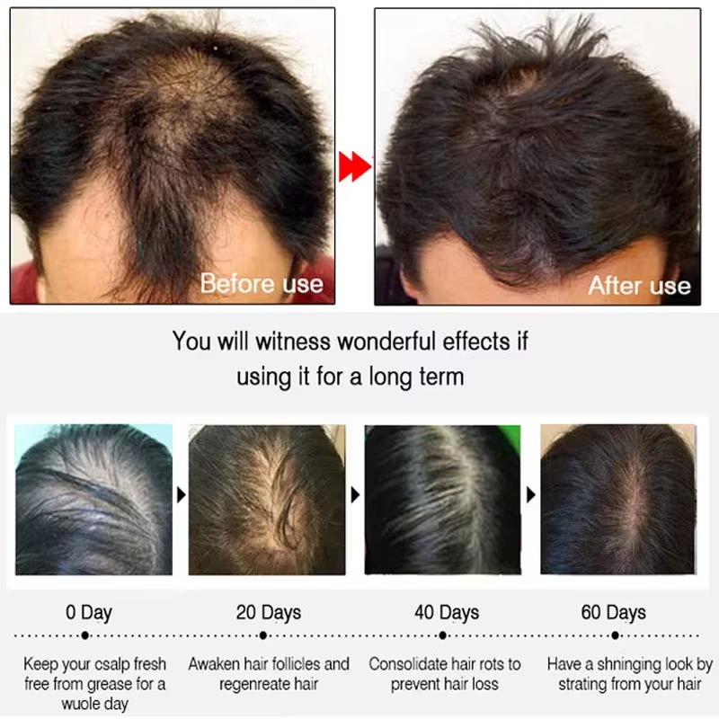بخاخ الزنجبيل السريع لنمو الشع - مراجعة Hair Care Lotion وسعره