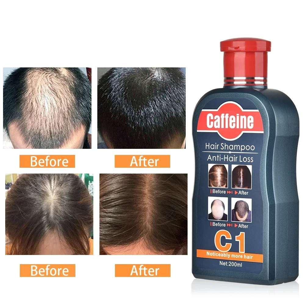 شامبو رجالي لنمو الشعر نباتات  - مراجعة Hair Care Korean Products وسعره